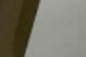 Буйнов страдает от боли из-за повреждения мениска