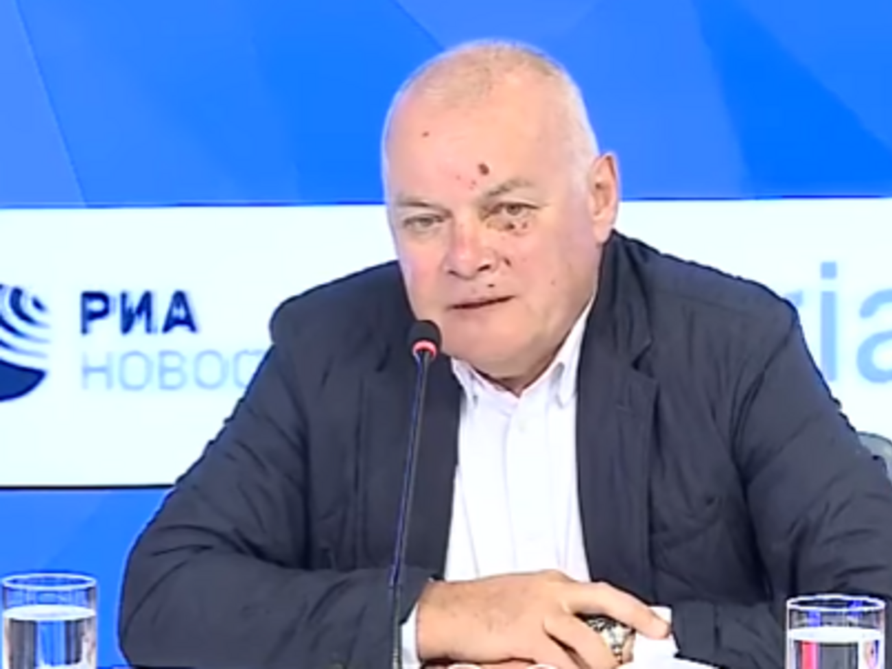 Киселев рассказал, как разбил лицо в Крыму