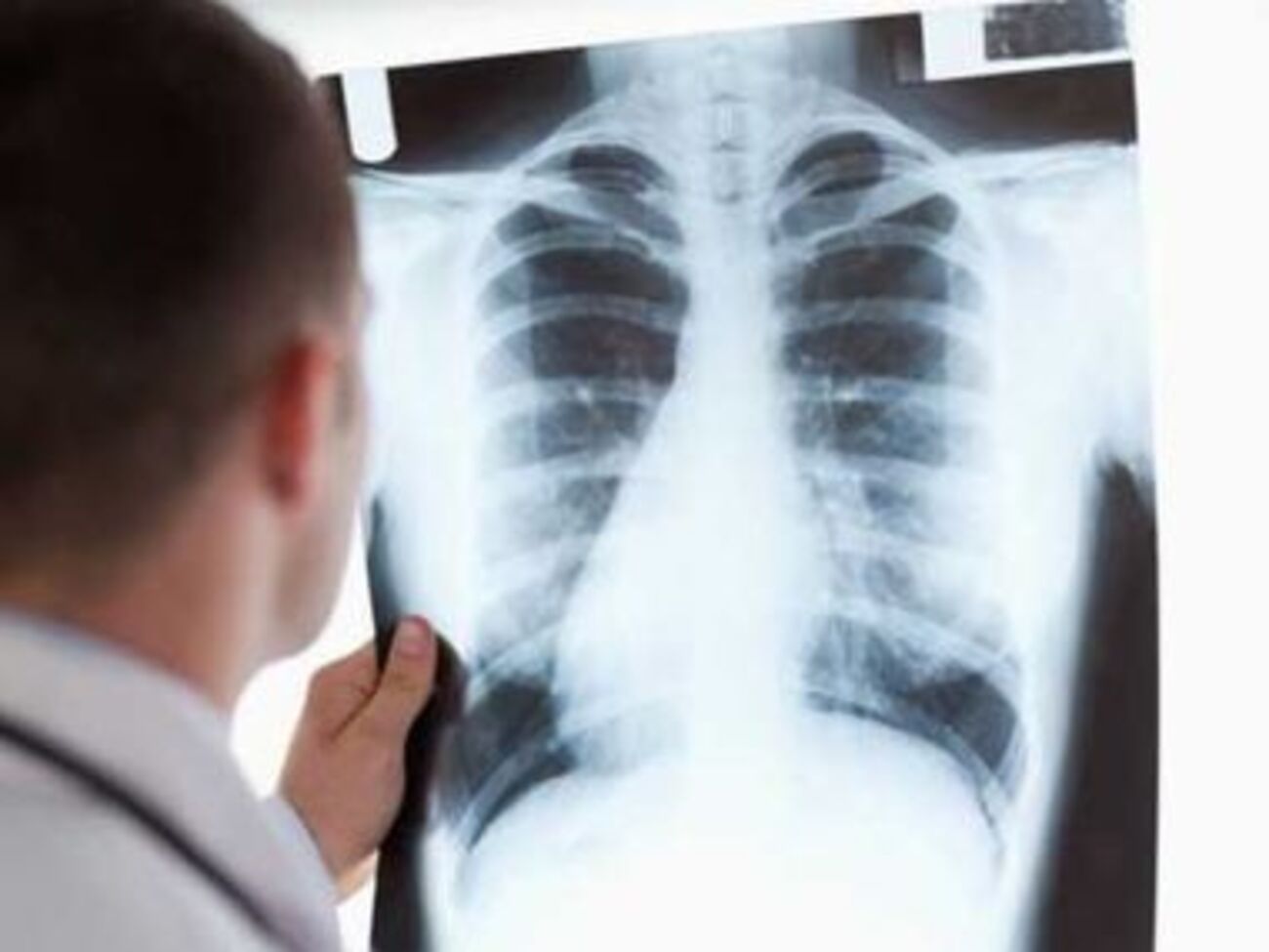 Синцов утверждает, что в 2016 году из 200 заболевших 20 составили беженцы из Донбасса