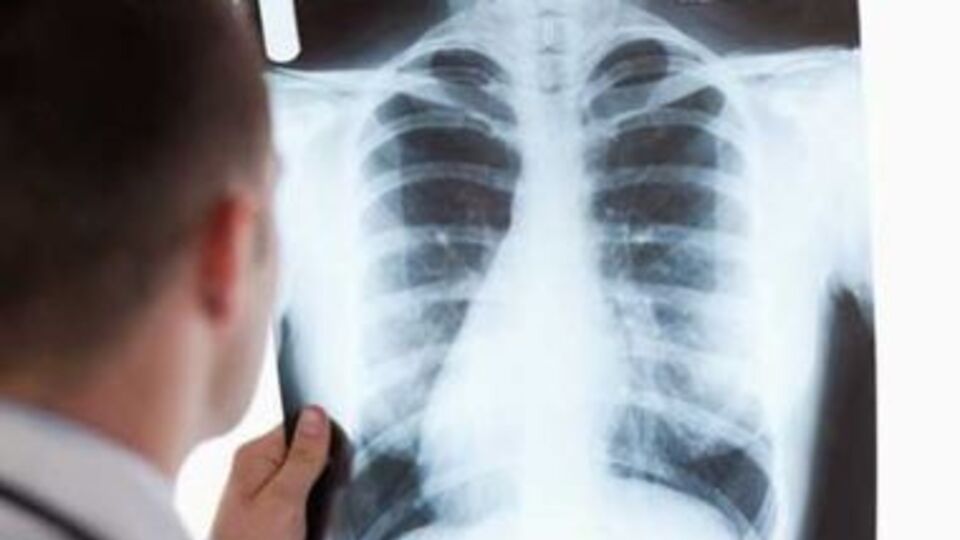 Синцов стверджує, що у 2016 році з 200 хворих 20 становили біженці з Донбасу