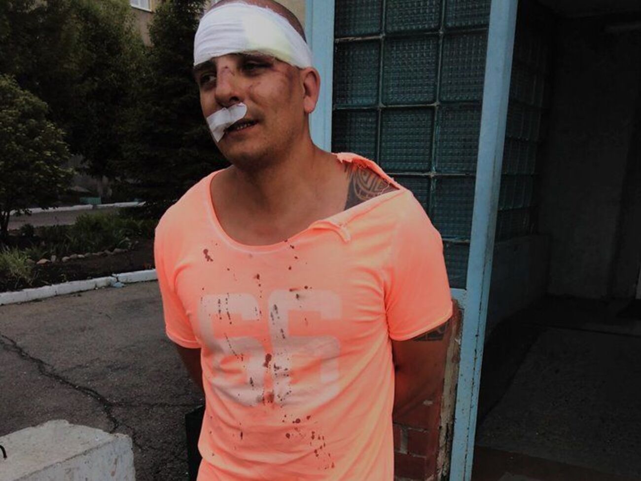 Пострадавшему наложили шесть швов, есть подозрение на сотрясение мозга