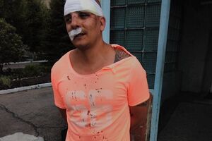 Пострадавшему наложили шесть швов, есть подозрение на сотрясение мозга