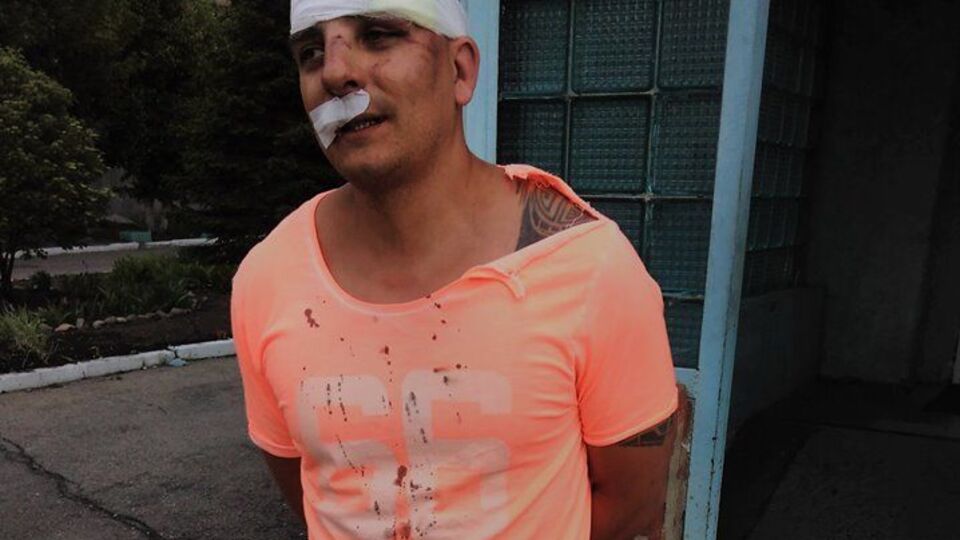 Пострадавшему наложили шесть швов, есть подозрение на сотрясение мозга