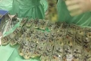 Гроші зберегли свій вигляд, але пацієнтці їх не віддали