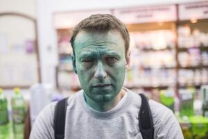 Навальний заявляв, що збирається їхати на лікування за кордон