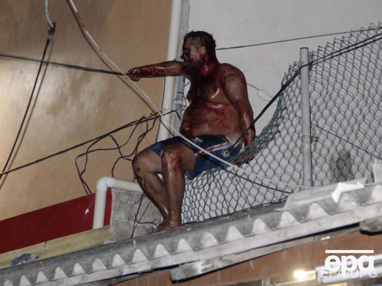 Блогер получил черепно-мозговую травму во время нападения мексиканцев