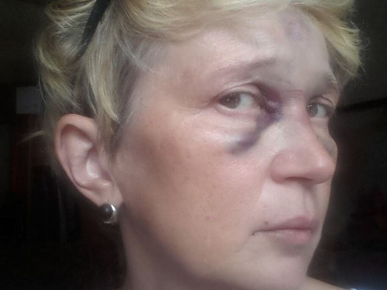 Камера зафиксировала, как двое злоумышленников после избиения журналистки уезжают на мопеде в сторону Тираспольской площади