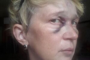 Камера зафиксировала, как двое злоумышленников после избиения журналистки уезжают на мопеде в сторону Тираспольской площади