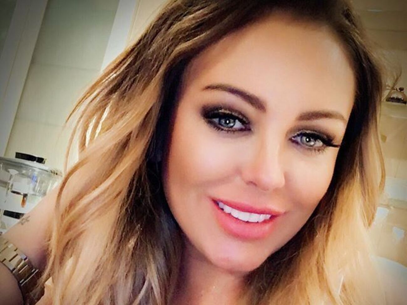 Подагру у Началовой диагностировали пять лет назад