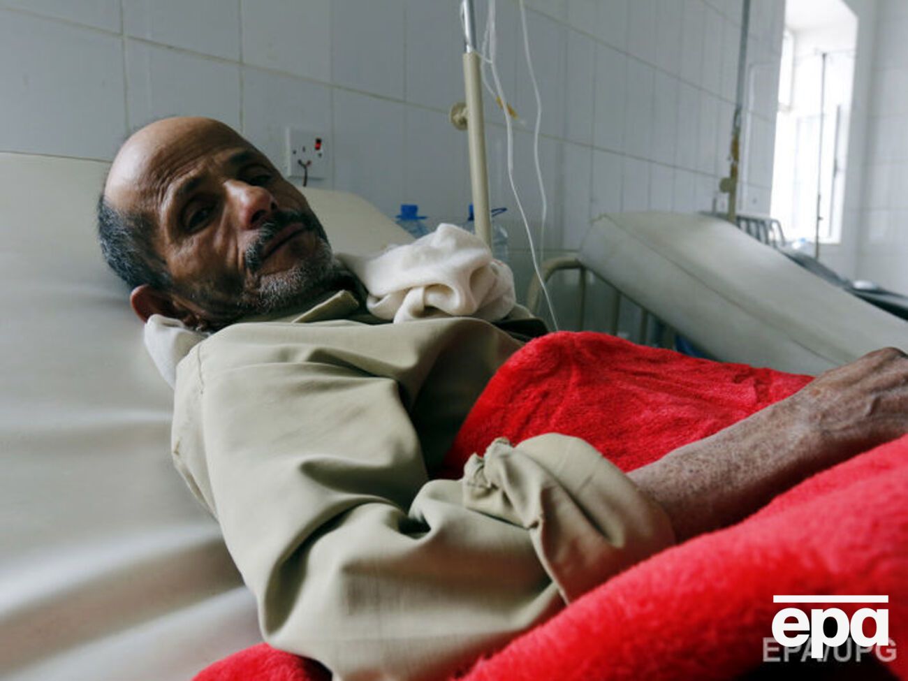 У Ємені &ndash; спалах холери