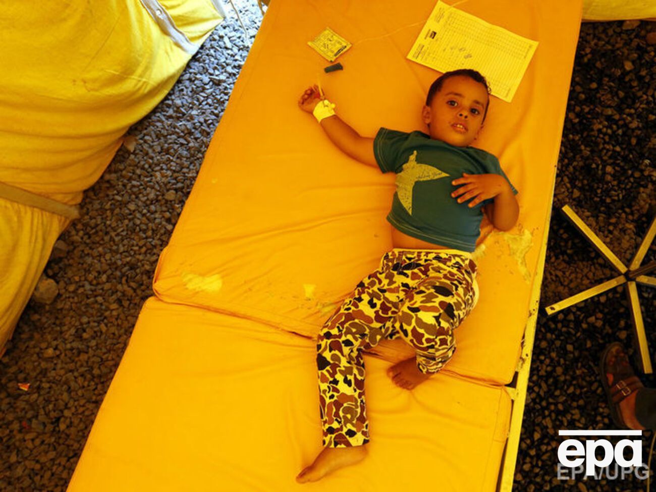 У Ємені недоїдає понад 2 млн дітей, що робить їх чутливими до холери