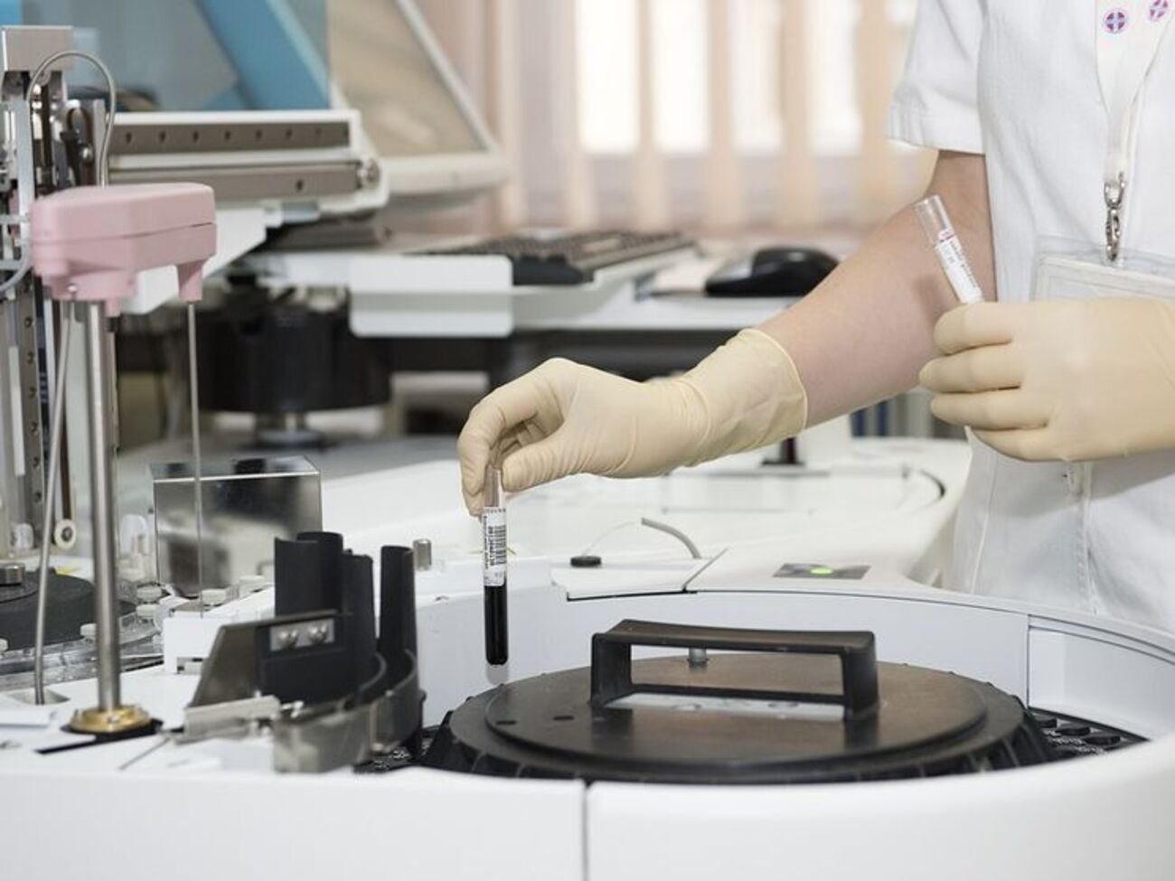 Розпочато епідеміологічне розслідування