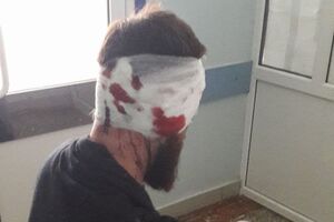 На Булаха напали сегодня днем