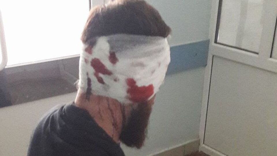 На Булаха напали сьогодні вдень