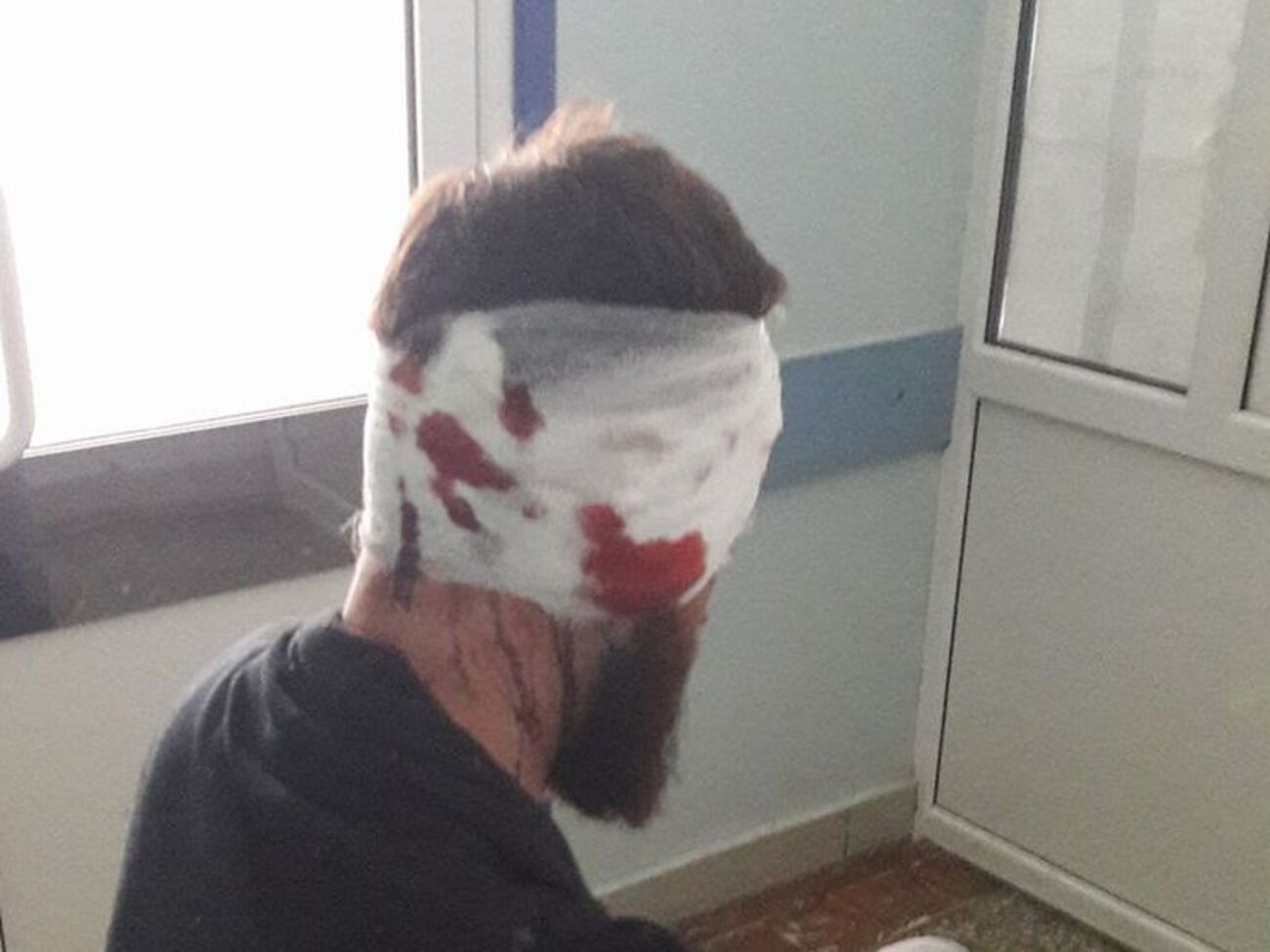 Геращенко сказал, что Булах (на фото) намерен продолжить свою антикоррупционную деятельность, несмотря на нападение