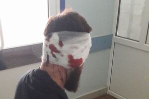 Геращенко сказал, что Булах (на фото) намерен продолжить свою антикоррупционную деятельность, несмотря на нападение