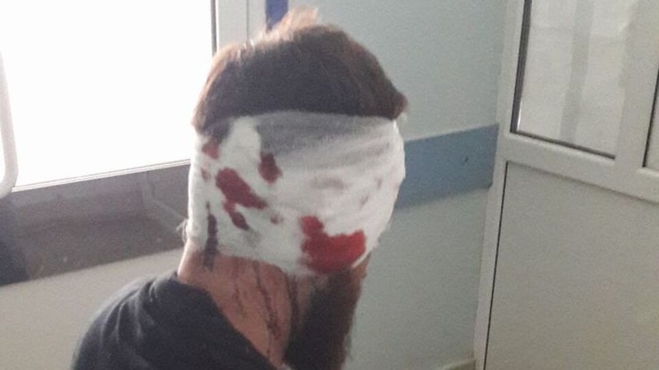 Геращенко сказал, что Булах (на фото) намерен продолжить свою антикоррупционную деятельность, несмотря на нападение