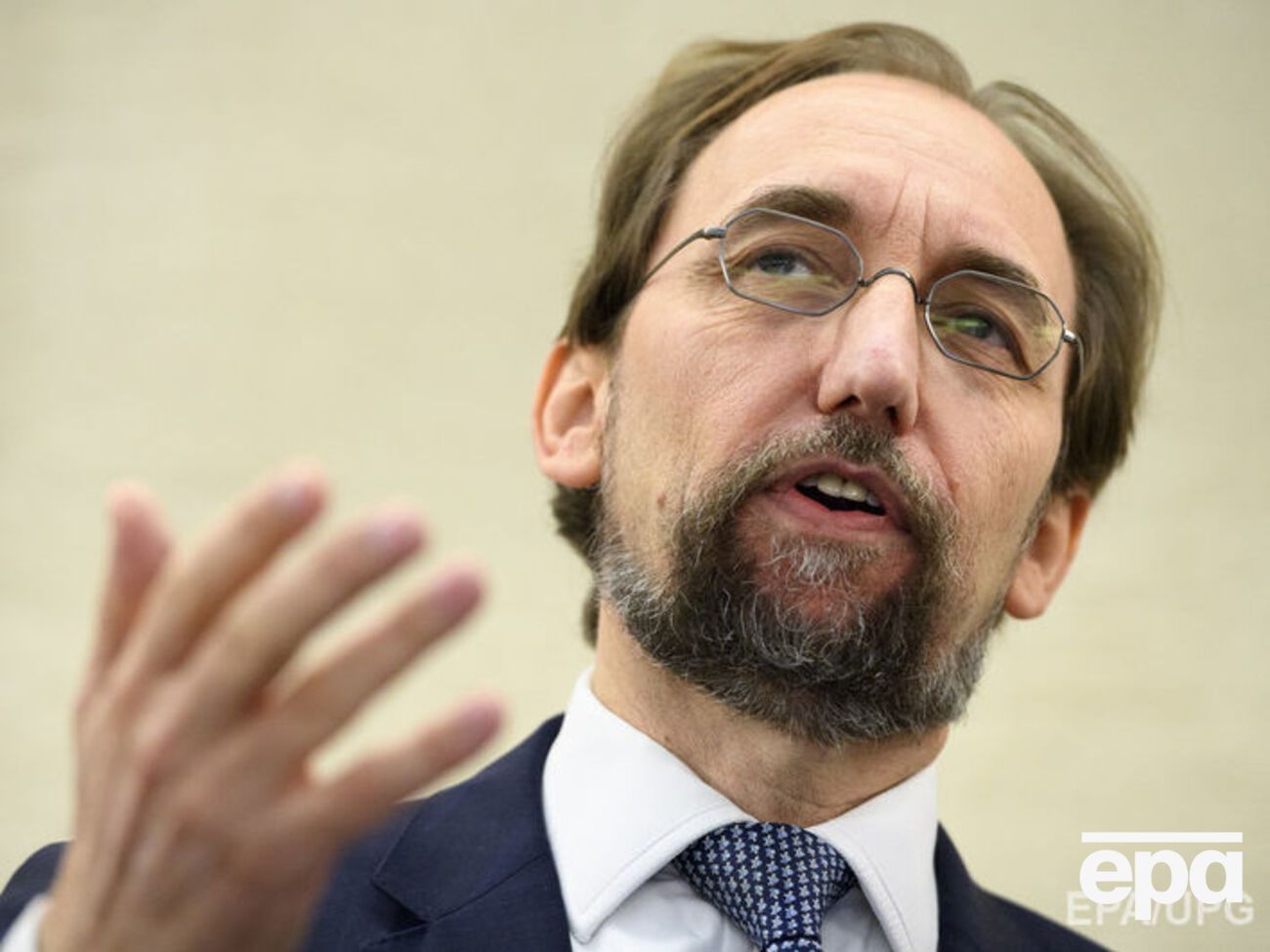 Зейд Раад ал-Хусейн рассказал, что холерой в Йемене с апреля 2017 года заболели около 650 тыс. человек