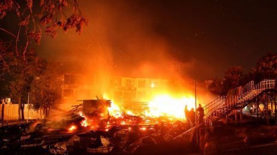 Пострадавшая при пожаре девочка чувствует себя лучше