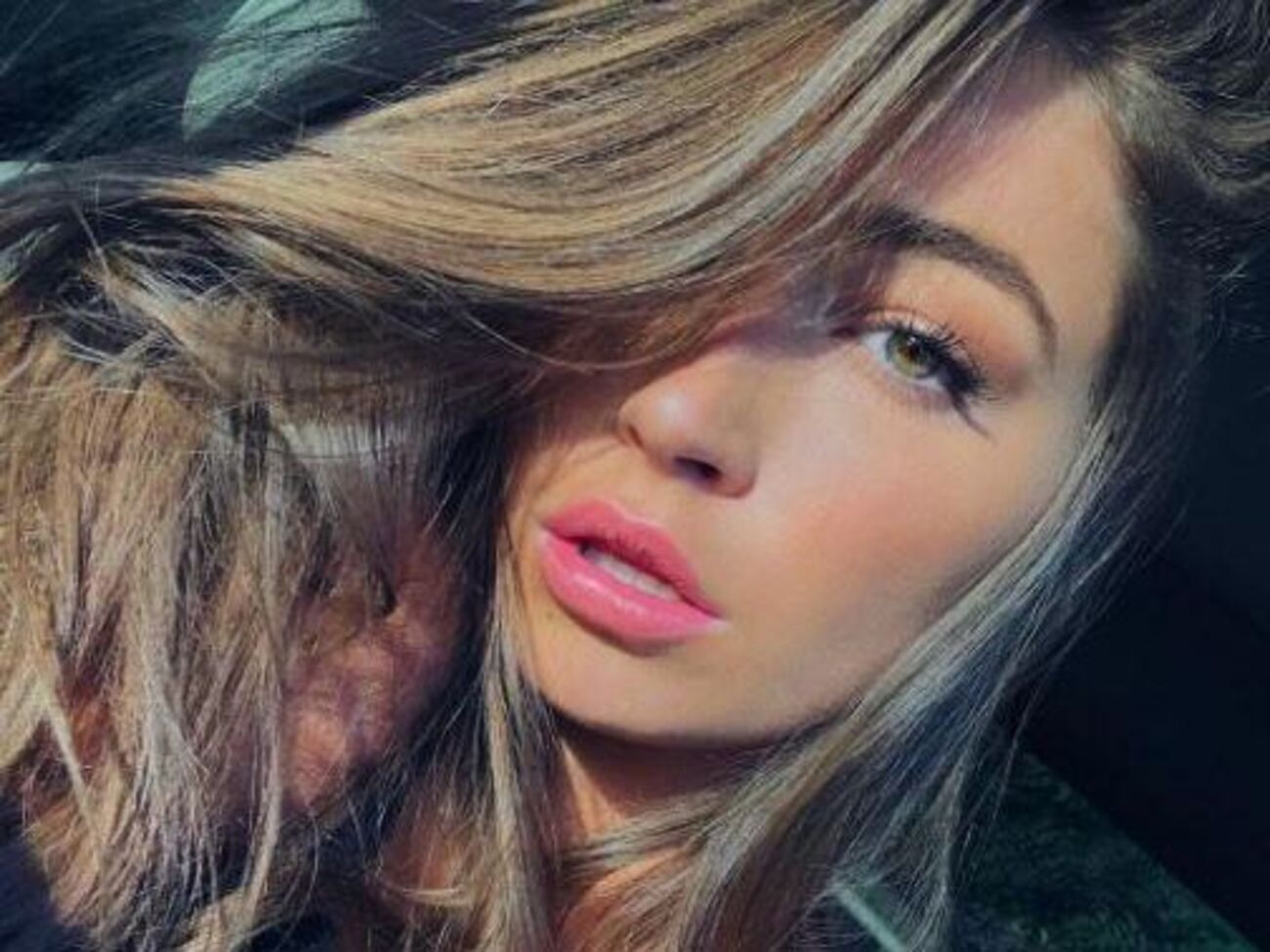 Хьюитт сняла побои