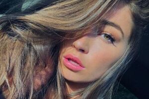 Хьюитт сняла побои