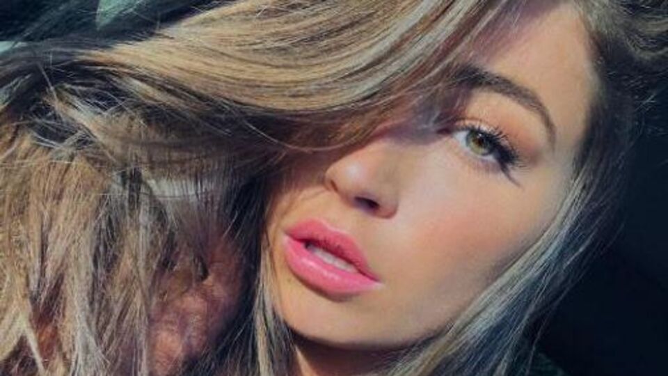 Хьюитт сняла побои