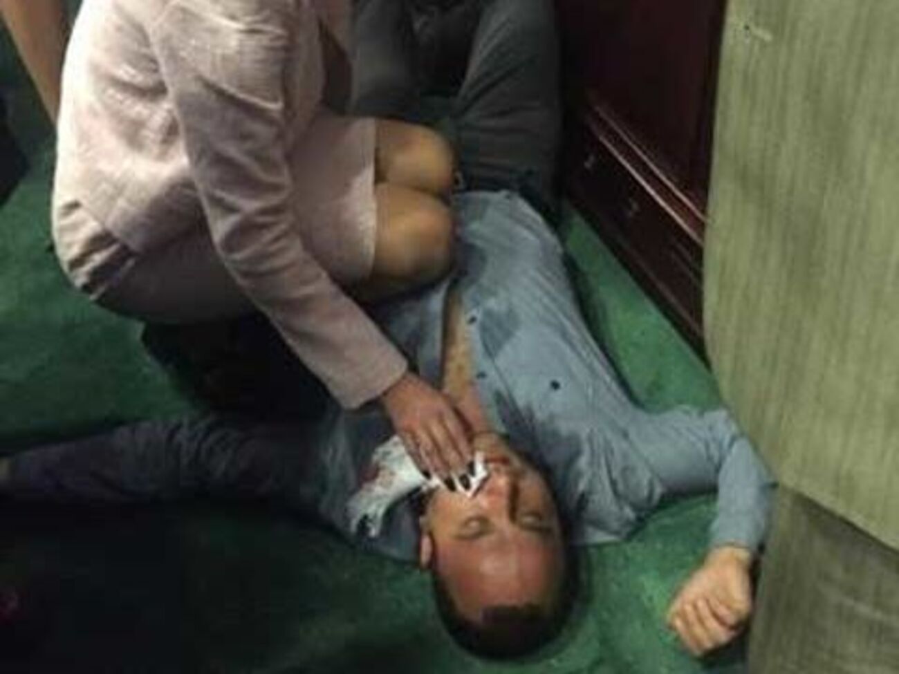 У Хахулина диагностировали сотрясение мозга и перелом челюсти