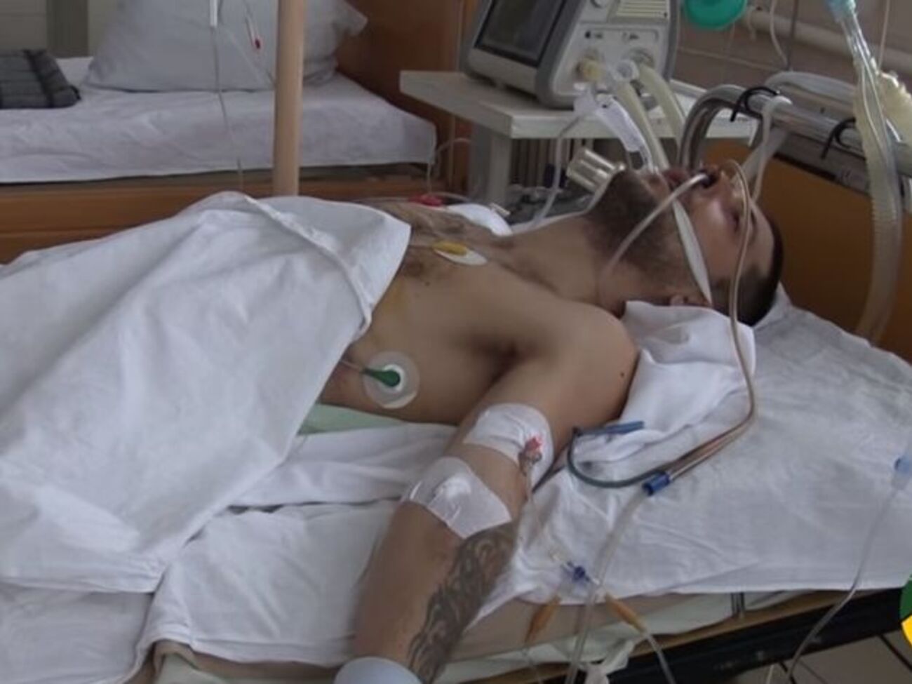 Стан затриманого диверсанта вкрай важкий