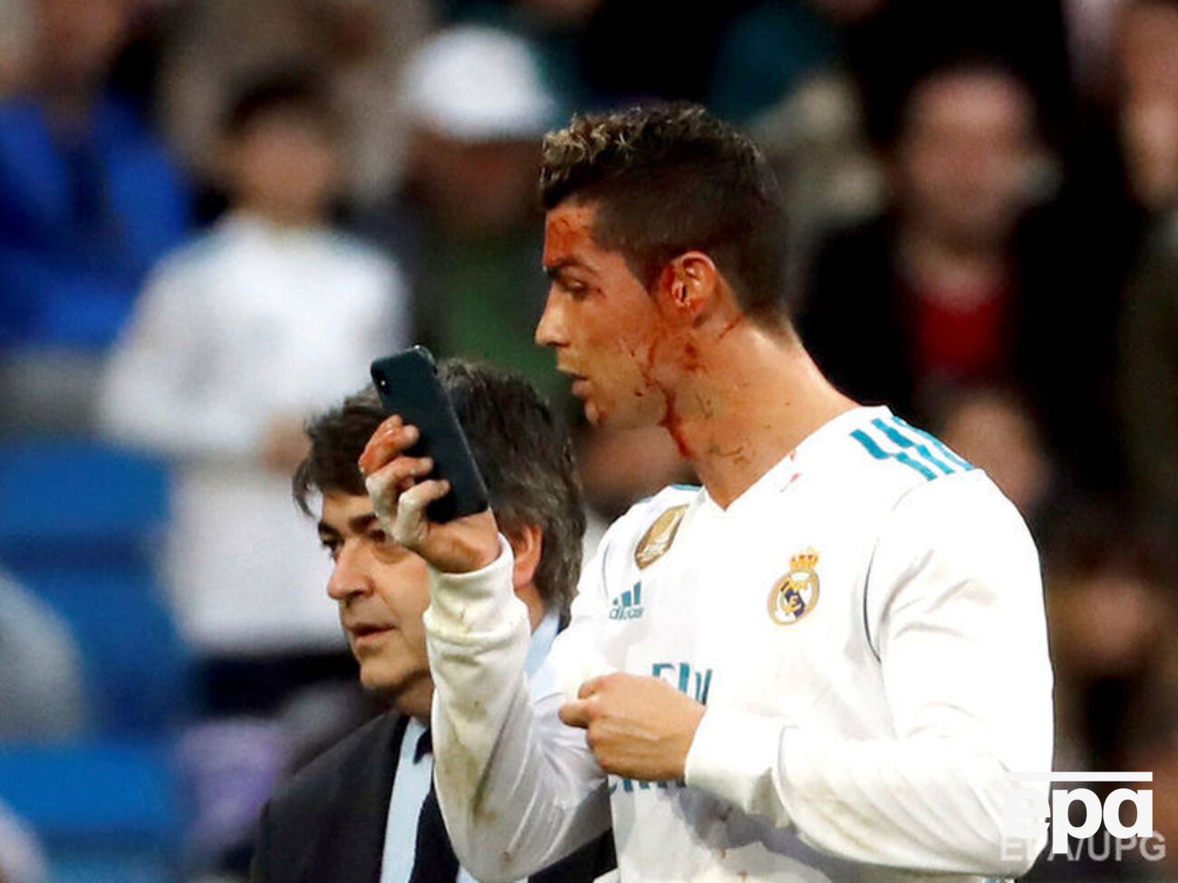 Лицо футболиста было в крови