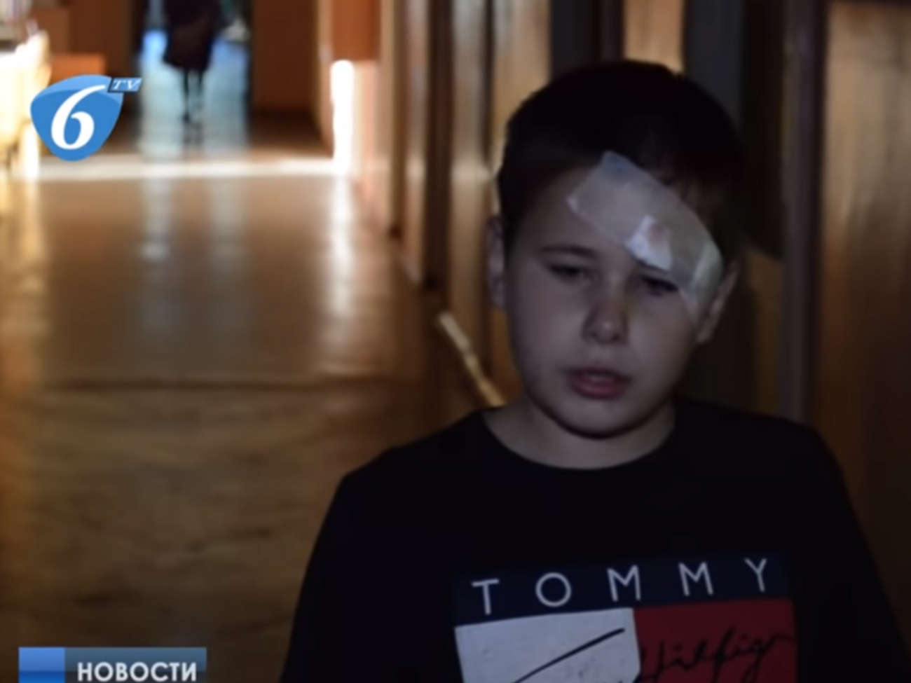 Тулуп ранен в руку и голову