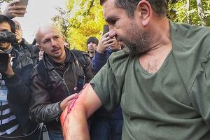 По данным СМИ, в ходе потасовки под МВД пострадал один мужчина