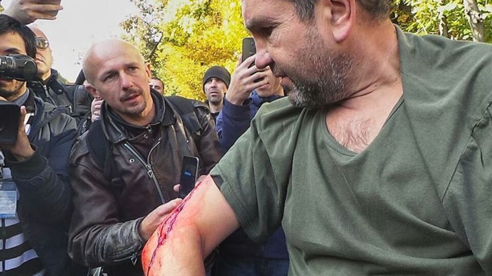 По данным СМИ, в ходе потасовки под МВД пострадал один мужчина