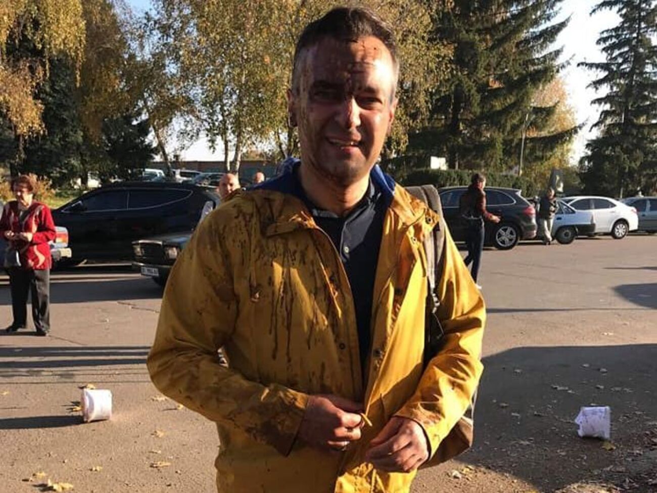 Полиция получила ориентировку на задержание напавших на журналиста Гнапа