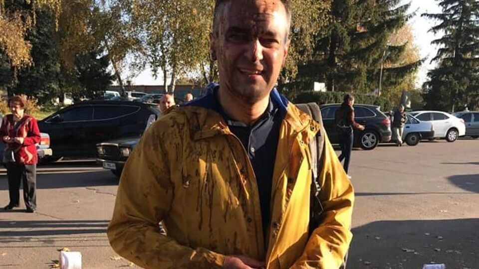 Полиция получила ориентировку на задержание напавших на журналиста Гнапа