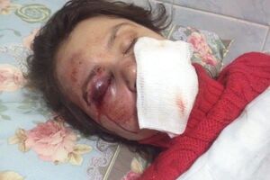 Черновол была жестоко избита в ночь на 25 декабря 2013 года