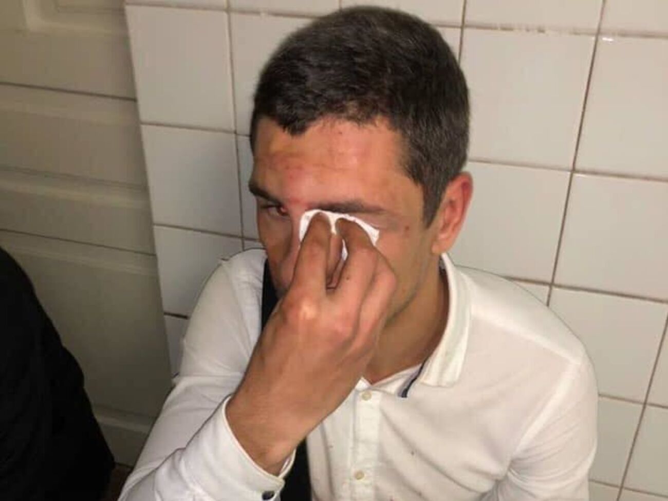 Ляшко: Очевидно, причина нападу &ndash; акції протесту, які проводило молодіжне крило Радикальної партії під "Укравтодором" і "Нафтогазом" проти свавілля цих структур