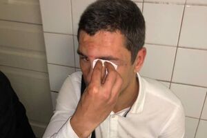 Ляшко: Очевидно, причина нападу – акції протесту, які проводило молодіжне крило Радикальної партії під "Укравтодором" і "Нафтогазом" проти свавілля цих структур