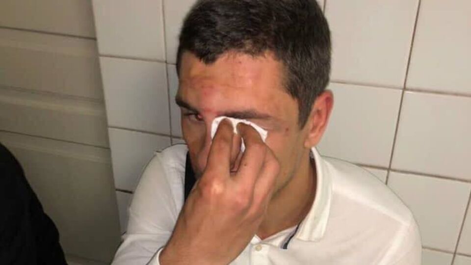 Ляшко: Очевидно, причина нападения – акции протеста, которые проводило молодежное крыло Радикальной партии под “Укравтодором“ и “Нафтогазом” против произвола этих структур