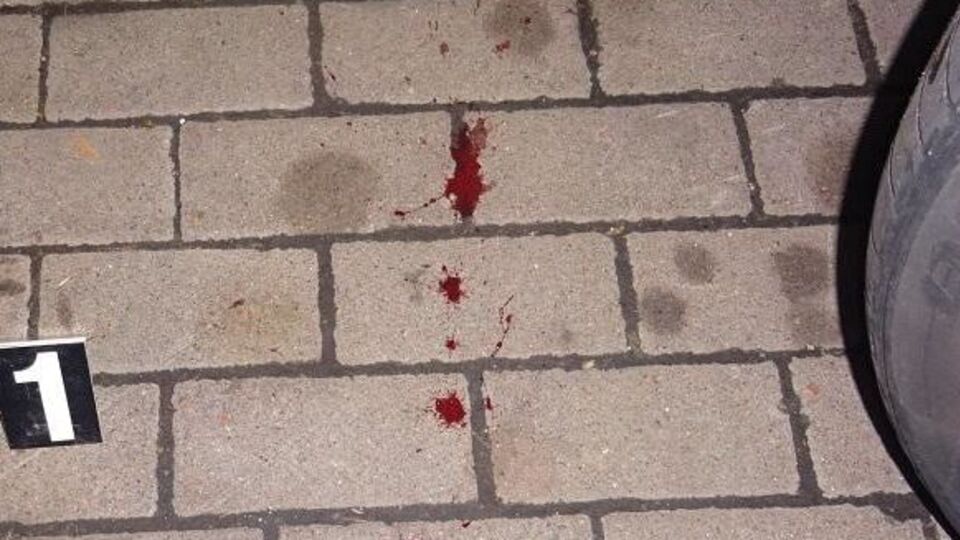 Одна людина дістала поранення з вогнепальної зброї внаслідок конфлікту