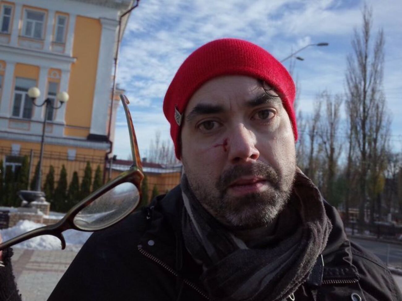 За словами Колборна, на нього нападали двічі