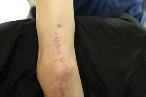 Костенко проходит реабилитацию после пыток в оккупированном Крыму