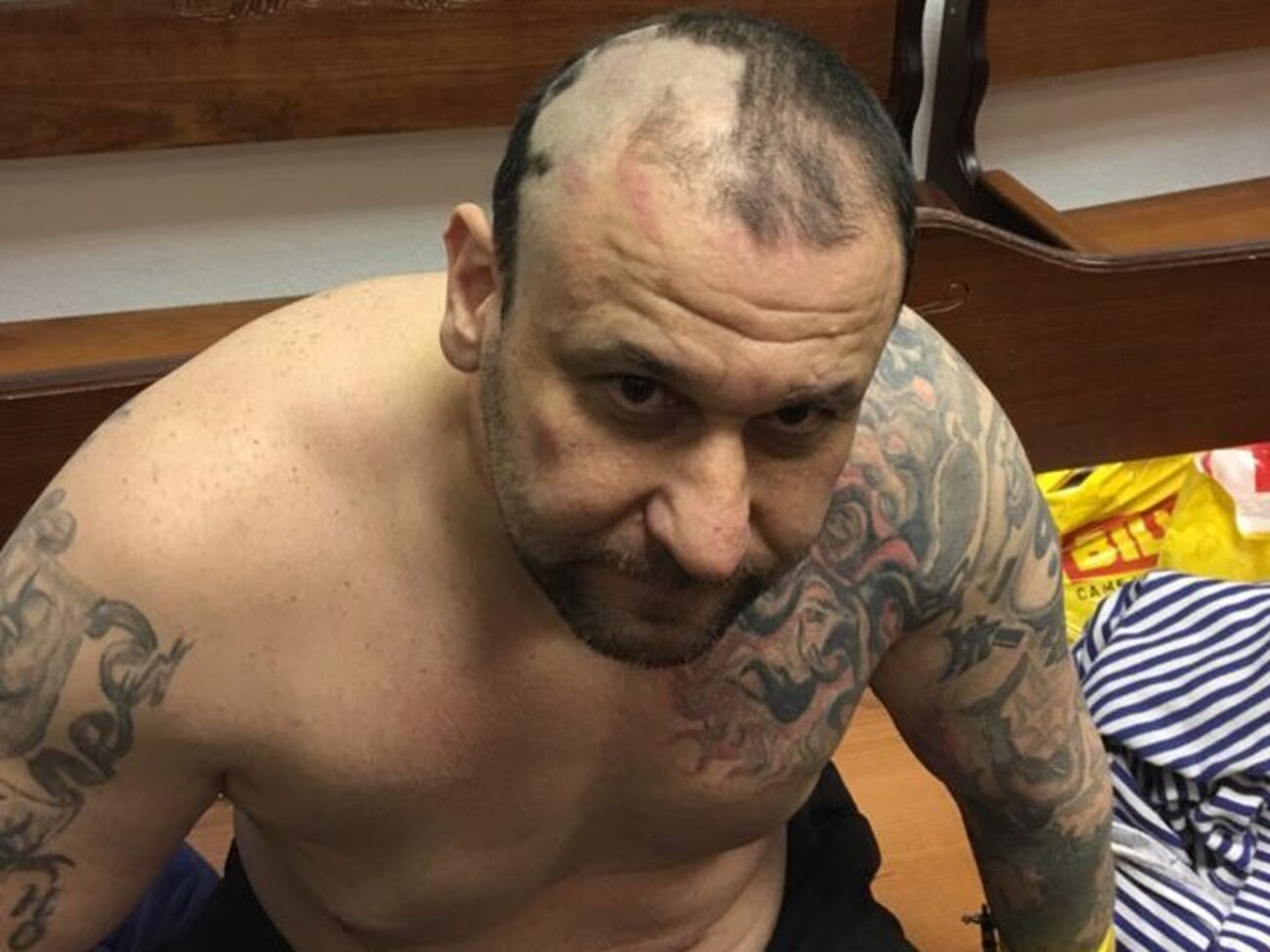 Онищенко показал свои травмы и во всем обвинил сотрудников СИЗО