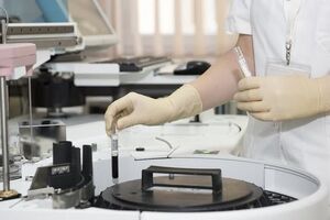 У серпні 2017 року в Криму було зафіксовано 22 тис. нових випадків зараження ВІЛ