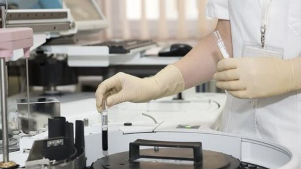 В августе 2017 года в Крыму было зафиксировано 22 тыс. новых случаев заражения ВИЧ