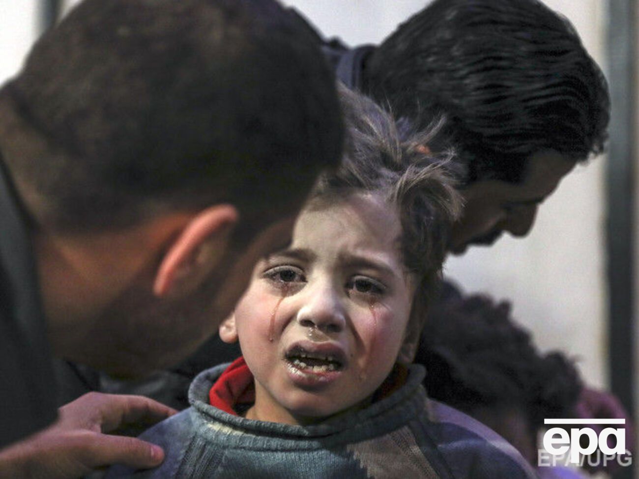 Раненный в результате последних обстрелов ребенок в больнице, контролируемой повстанцами Думы (Восточная Гута)