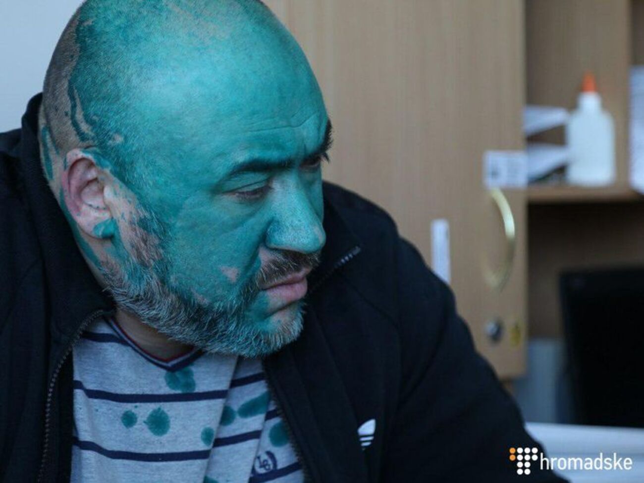 "Від радості Крисін вилив на себе зеленку". Активісти відвідали фігуранта справи про вбивство Веремія в Інституті серця. Фоторепортаж