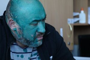 "Від радості Крисін вилив на себе зеленку". Активісти відвідали фігуранта справи про вбивство Веремія в Інституті серця. Фоторепортаж