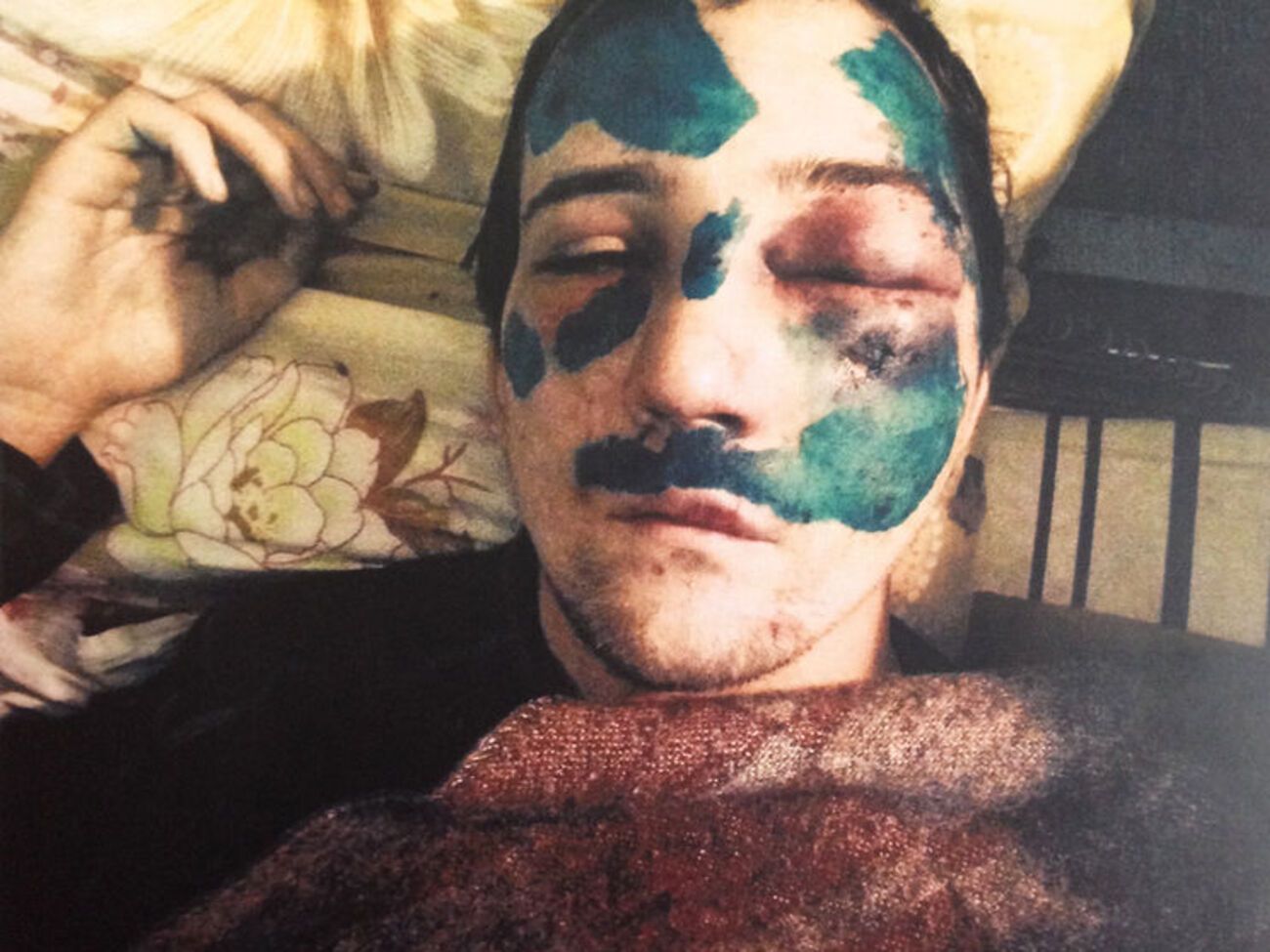 Владислав Цилицкий сразу после избиения в 2014 году (слева) и во время показаний в суде в 2018-м (справа)