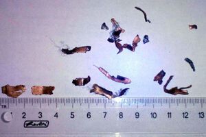 Вибух невідомого предмета стався на кухні, де гралися діти