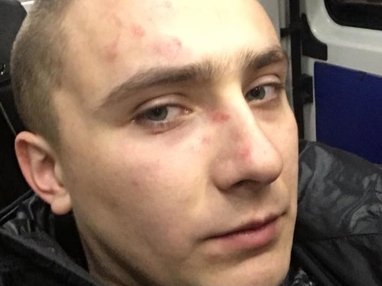 Активист опубликовал свои фото после нападения
